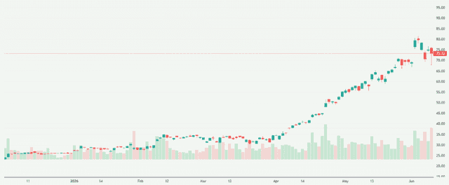 Meyka AI: STMicroelectronics N.V. (STM) Stock Overview, June 10, 2026